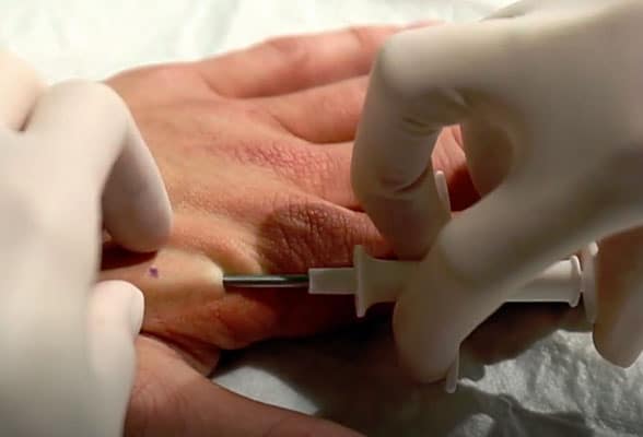 An NFC chip is injected into a Tele2 employee's hand