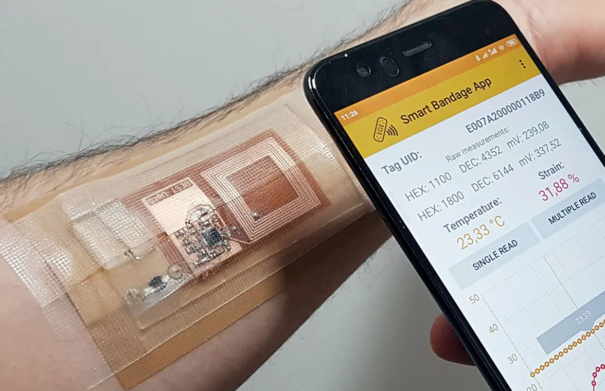 NFC smart bandage with smartphone